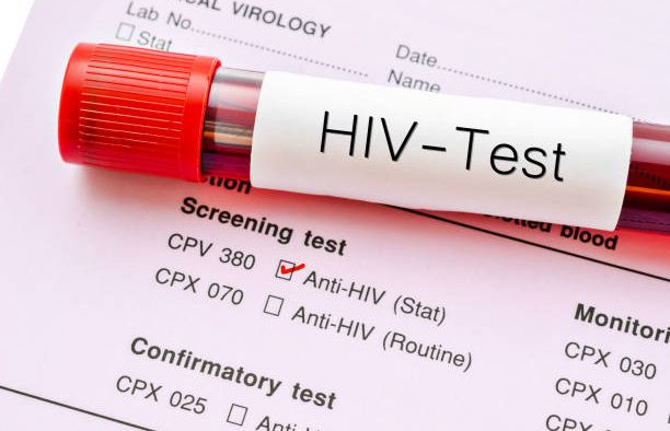 Xét nghiệm HIV tự nguyện và bắt buộc